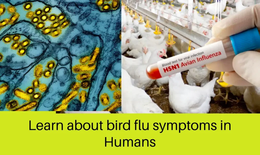 Learn about bird flu symptoms in humans