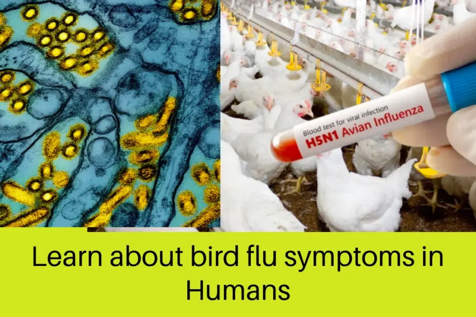 Learn about bird flu symptoms in humans